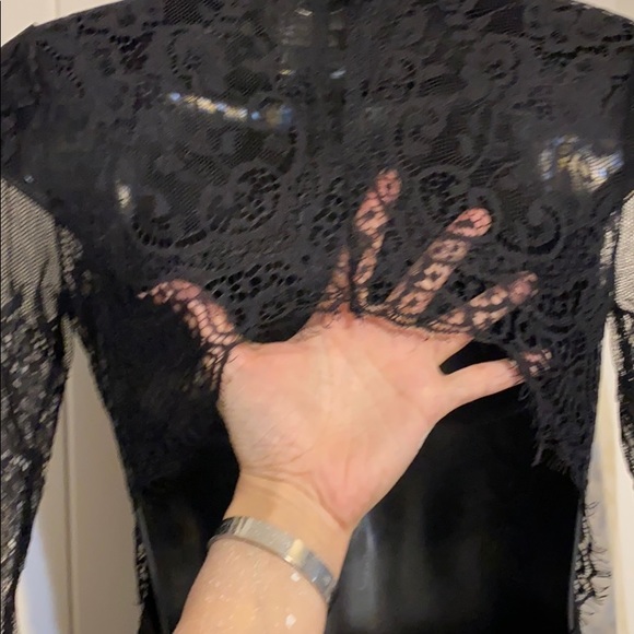 Black open back lace detail dress - Picture 5 of 6